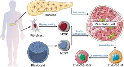 In vitro beta-cell killing models using immune cells and human pluripotent stem cell-derived islets: Challenges and opportunities